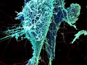 The Ebola Virus. Image from NIAID (Ref. 2).
